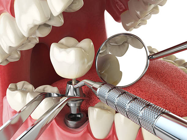 Best Emergency Treatment for Dental Infections or Abscesses in Dane, WI