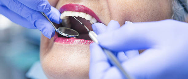 Best Emergency Root Canal Treatment in Dane, WI